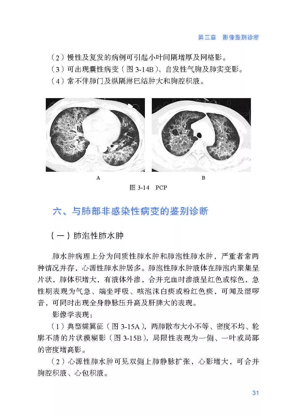 新冠肺炎最新报道，全球疫情动态与应对策略概览